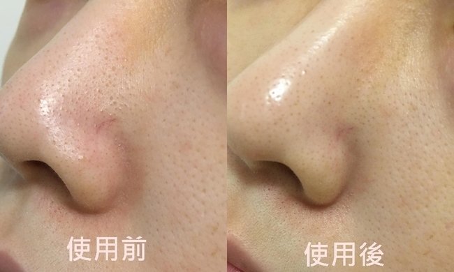 Urcosmepr 編輯帶你逛第一彈 盤點開架醫美保養神品 肌膚問題不需要濾鏡修修臉 靠它們讓困擾通通退散 Urcosmepr