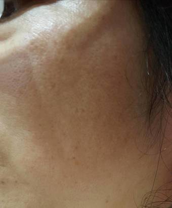 算是敏感肌，每次到了換季或是天氣變化大的日