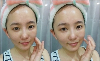 嫩!!我自己因為最近換季的關係臉頰還蠻容易