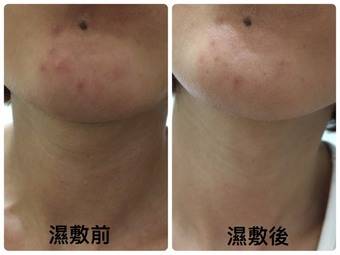 效(大概敷3天)正逢換季的季節，臉頰會有一