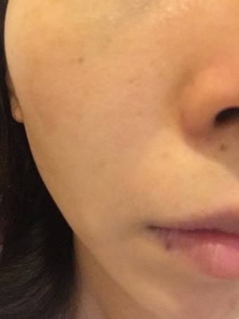 不是，剛好這陣子因為換季的關係，膚況很不穩
