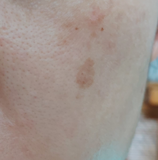 後沒有照顧好留下的如這個 後沒有照顧好留下的如這個