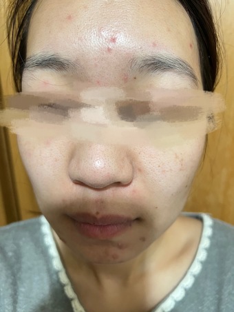 保濕、控油、雞蛋感的奶油肌但常常都在4-6