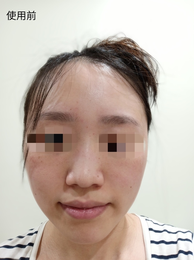 頰偏乾微紅其他膚況還算OK