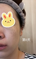 用組，剛好可以來試試早C晚A膚質：混合偏油