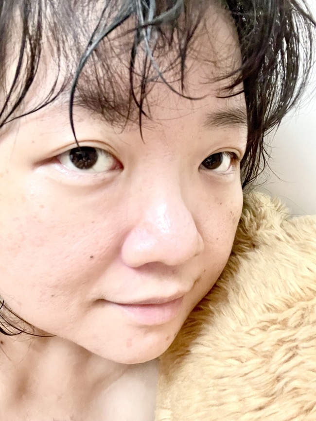 悶出痘後再來哀號也於事無補了