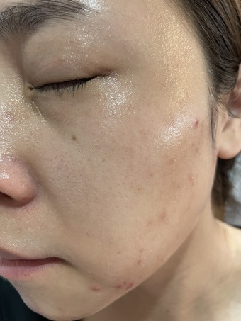 吸收後有保濕感但不會油膩 吸收後有保濕感但不會油膩