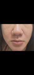 ＊~美顏小君~＊ - 京城之霜 超維A全能逆齡精華 使用心得圖片