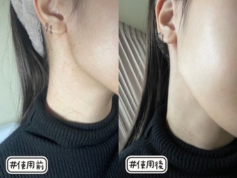 最後用保濕乳液抹臉頰 最後用保濕乳液抹臉頰