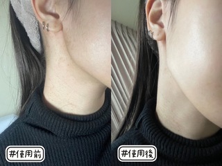 HJKL - 京城之霜 超維A全能逆齡精華 使用心得圖片