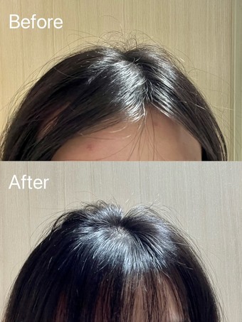 後續吹完的髮根對比如下 後續吹完的髮根對比如下
