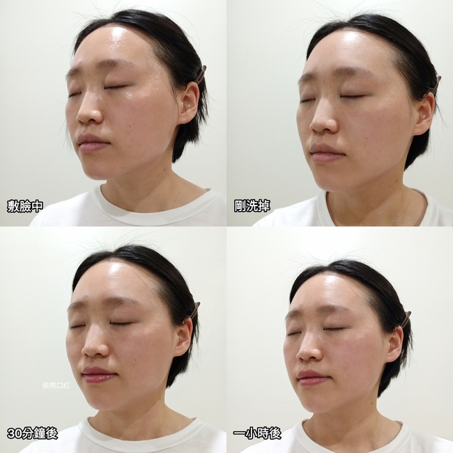 度但自評最初的不適感已消除↓ 度但自評最初的不適感已消除↓