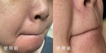 乾澀會保濕但保濕效果剛剛好