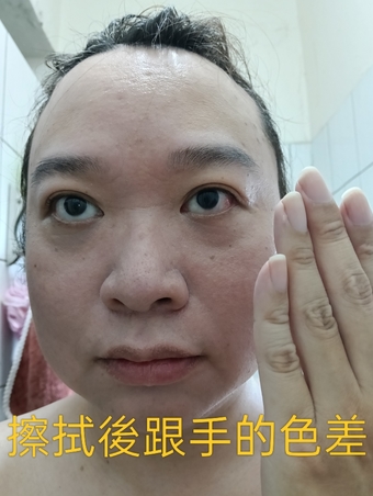 這些過敏症狀就比較沒出現 這些過敏症狀就比較沒出現