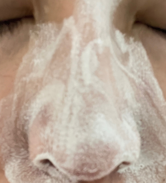 對油痘肌的我是有保水感的 對油痘肌的我是有保水感的
