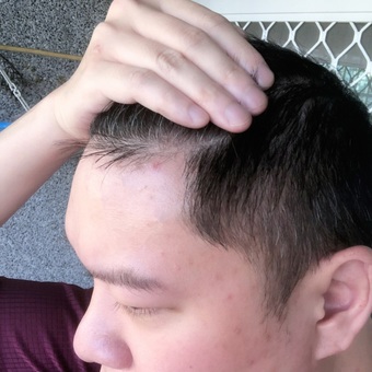 較多而且那邊比較容易孳生細菌 較多而且那邊比較容易孳生細菌