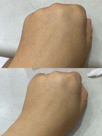 很好我才薄膚分鐘