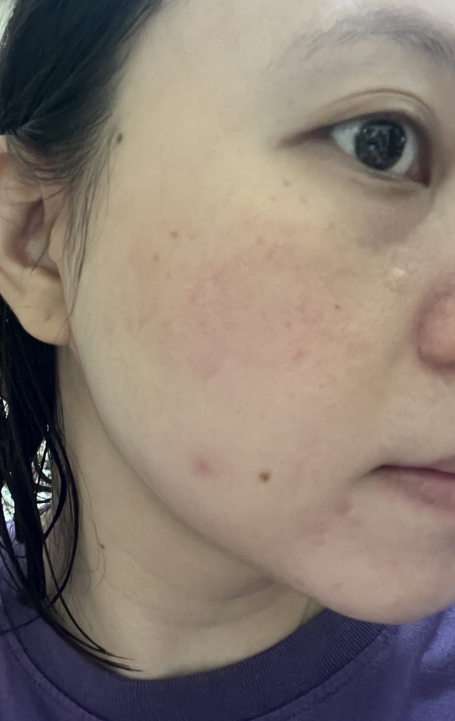 種粗大毛孔又混油肌膚的人🤣