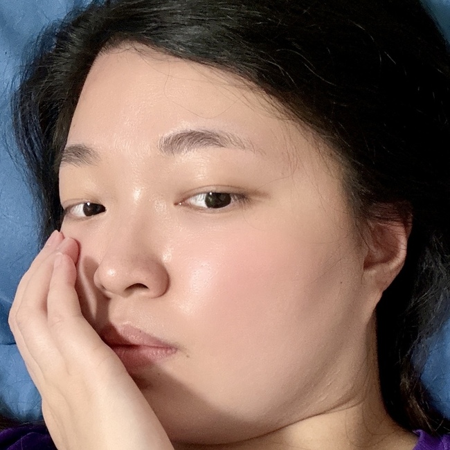 光直射皮膚一定要記得防曬喔 光直射皮膚一定要記得防曬喔