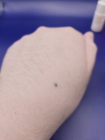 Furcasin - INNISFREE 維他命C淨亮精華 使用心得圖片