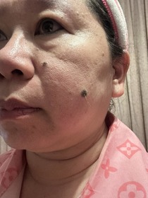 chjohnny - PAULA'S CHOICE 寶拉珍選 2%水楊酸精華液 使用心得圖片