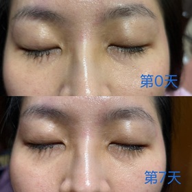 Shiori - SHISEIDO 資生堂國際櫃 激抗痕亮采緊緻ACE眼霜 使用心得圖片