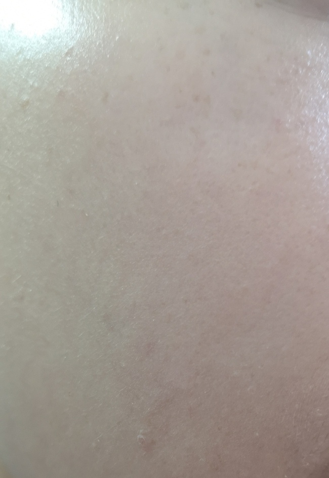 血管明顯臉上有很多顆粒起伏