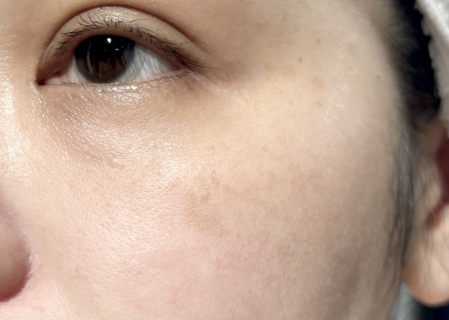 重▽▽▽▽▽使用前紀錄膚況