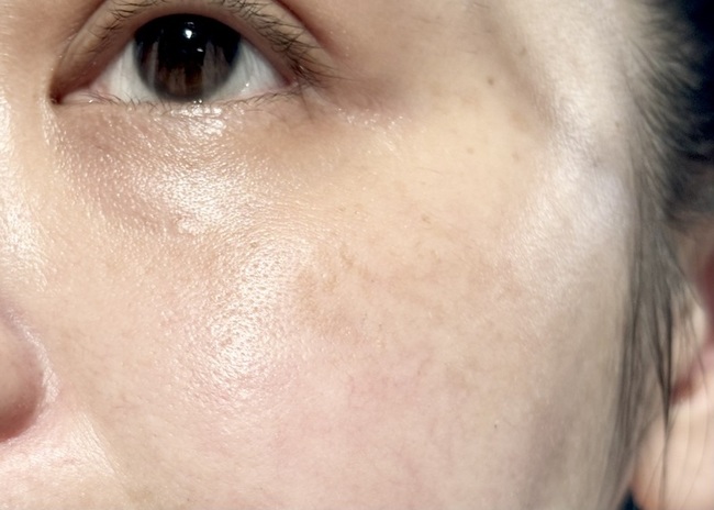 皮膚表面會呈現有一點點微成膜