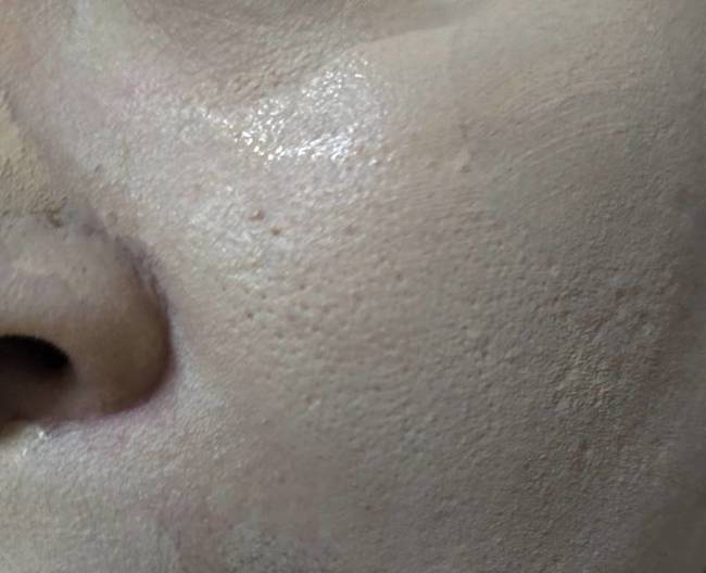 會出現大量爆炸的毛孔 會出現大量爆炸的毛孔