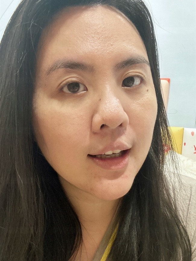 後大約小時的狀態如下