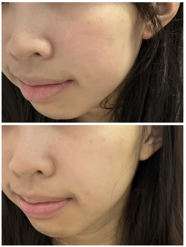 擾敏感肌友善必須再推一次