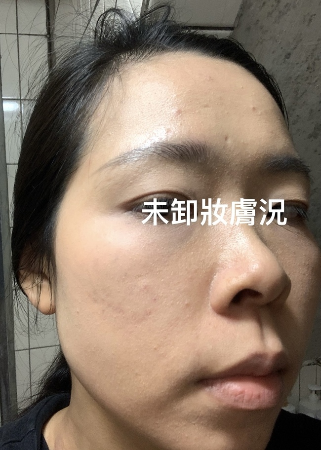 使用第一天因換季膚況不穩 使用第一天因換季膚況不穩