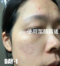 00KAT00 - Neogence 霓淨思 2% 6酸抗菌控油潔顏露 使用心得圖片