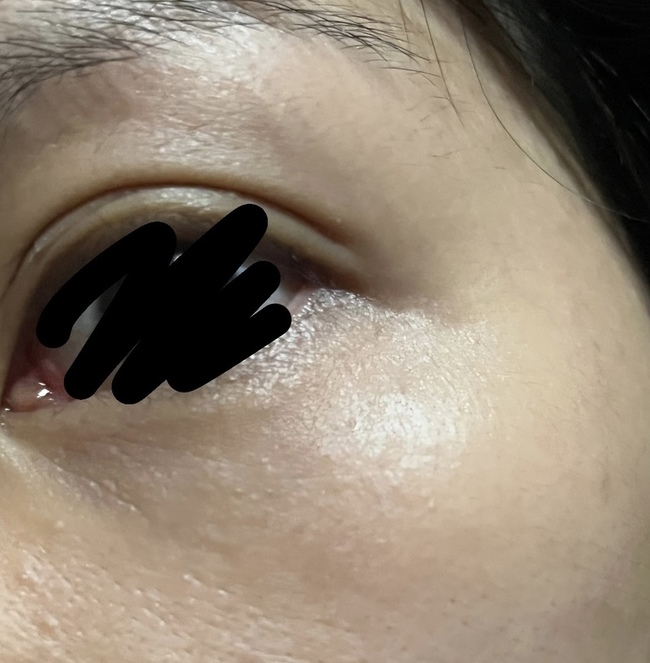 但還是看得出眼周的細紋很明顯