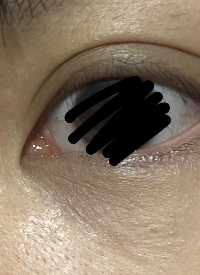 實際使用無產生肌膚變白的效果
