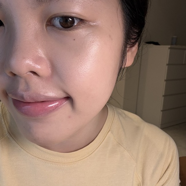 臉頰毛孔鼻翼泛紅黑眼圈問題