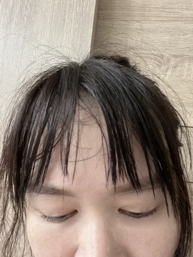 gimg