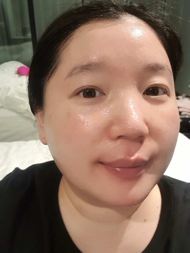 痘痘跟粉刺真的是蠻不錯的