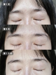 YUYUN - LANCÔME 蘭蔻 超極限肌因賦活露 使用心得圖片
