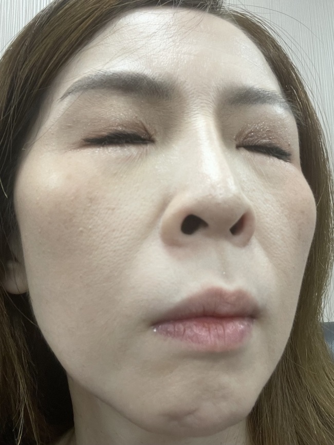 推開⬆️整體就會非常的服貼