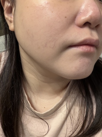 為敏肌人真的只求皮膚乖乖🥹