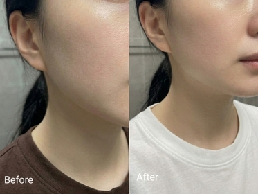 Kivice - Elizabeth Arden 伊麗莎白雅頓 黃金肌因修護膠囊 使用心得圖片