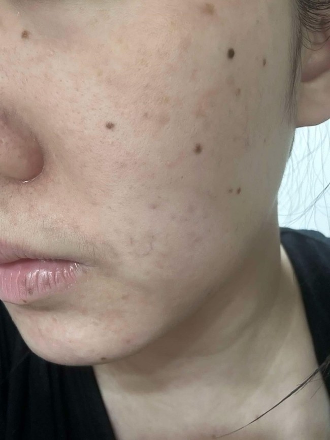 而且手一碰臉就黏黏的