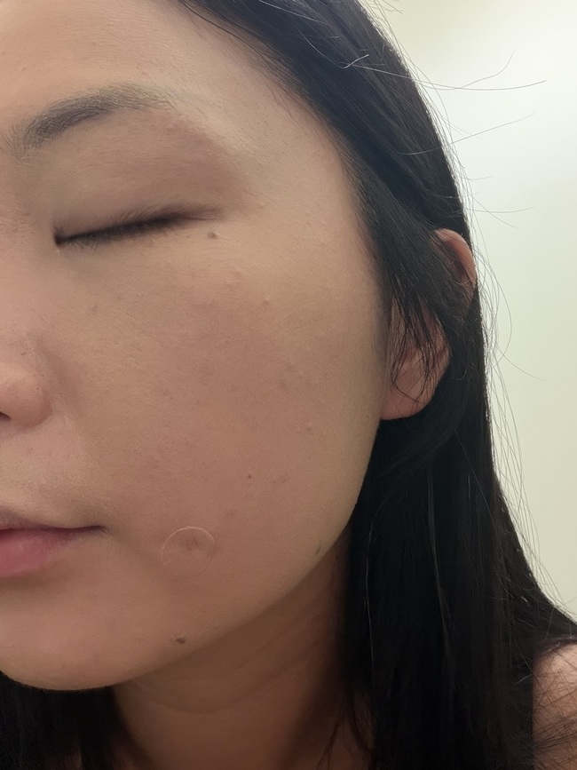 最近的膚況超級無敵差