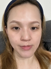 佳菲 - My Beauty Diary 我的美麗日記 玻尿酸B5修護面膜 使用心得圖片