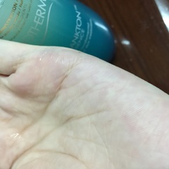 養因為最近不知道是否換季(？)的關係，